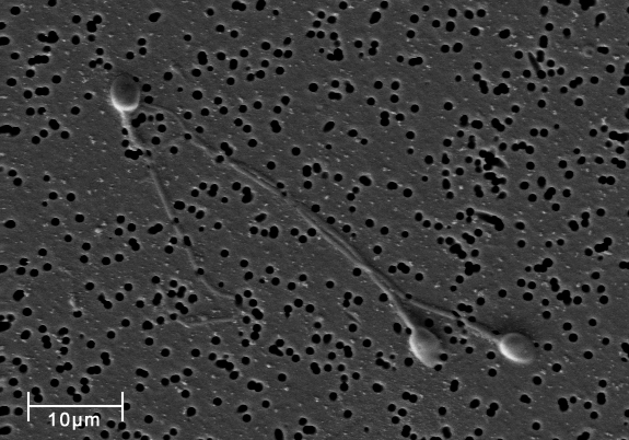 Spermatozoa-human-3140x